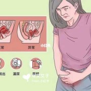 孕期子宫脱垂的症状（孕期子宫脱垂的症状是什么）