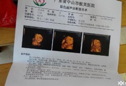 三维彩超结果怎么看,胎儿三维彩超图片好丑