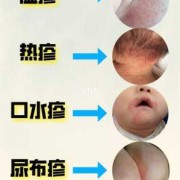 皮肤病会影响胎儿吗（皮肤病会影响胎儿吗）