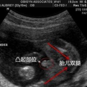 胎儿头圆还是椭圆好（胎儿头圆还是椭圆好看）