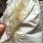 为什么怀孕了初期没有白带呢，出现这种情况算不算正常的,