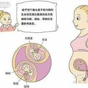 双胞胎孕期注意事项（双胞胎孕期注意事项有哪些）