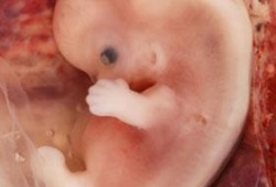 怀了25周的胎儿，如果这时候出生的话，宝宝可以存活下来吗,怀孕二十五周胎儿图像怎么看
