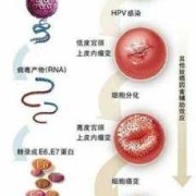 hpv对胎儿有影响吗（怀孕后感染hpv对胎儿有影响吗）