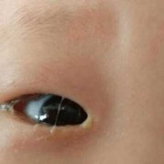 宝宝哭有时没眼泪？新生儿会有眼泪吗,6个月的胎儿会哭吗