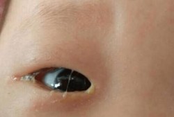 宝宝哭有时没眼泪？新生儿会有眼泪吗,6个月的胎儿会哭吗