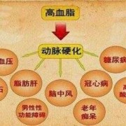 孕期 高血脂（孕期高血脂症对胎儿的影响）