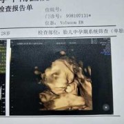 胎儿大排畸检查（大排畸多少周可以做）