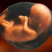 39周宝宝在肚子里的模样,孕39周胎儿图片欣赏