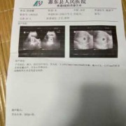 6周大胎儿（怀孕6周能多走路吗）
