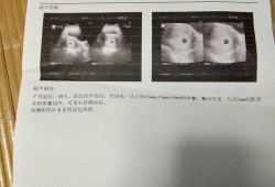 6周大胎儿（怀孕6周能多走路吗）