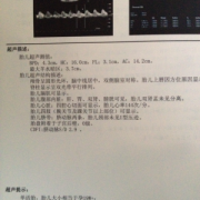 孕19周做二维彩超可以检查什么多吗,19周胎儿彩超标准数值