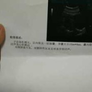 胎儿没胎心是缺叶酸（怀孕有40天了，检查看不见胎心胎芽，这是怎么回事呢）