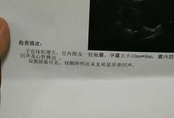 胎儿没胎心是缺叶酸（怀孕有40天了，检查看不见胎心胎芽，这是怎么回事呢）