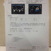 胎儿心脏超声检查多少钱（胎儿心脏彩超费用）