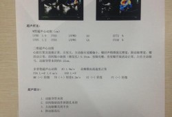 胎儿心脏超声检查多少钱（胎儿心脏彩超费用）