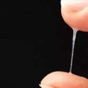 孕期分泌物（孕妇白带多怎么回事）