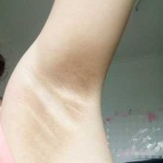 孕期腋窝有味（孕期腋窝有味道怎么办）