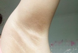 孕期腋窝有味（孕期腋窝有味道怎么办）