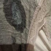 孕期白带糊状（白带糊状像酸奶一样，真的好希望我可以快点好起来）