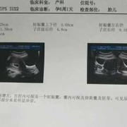 怀孕多久有胎芽,孕期胚芽是在几周内出现?