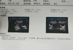 怀孕多久有胎芽,孕期胚芽是在几周内出现?
