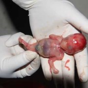 孕32周胎儿在肚子里一抖一抖的怎么回事,胎儿突然猛的一抖是吓到了吗