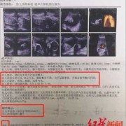 怀孕四个月胎儿彩超图（四维彩超官宣文案）