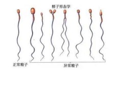 胎儿畸形与精子有关吗（胎儿畸形与精子有关吗）
