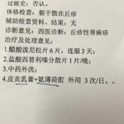 孕期寻麻疹（孕期寻麻疹怎么治疗）