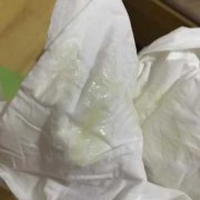 孕期水样白带是怎么回事（为什么白带像水一样流着的呢，孕妇这样的症状是羊水破了吗，怎么办啊）