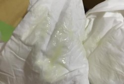 孕期水样白带是怎么回事（为什么白带像水一样流着的呢，孕妇这样的症状是羊水破了吗，怎么办啊）