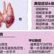 孕期甲状腺结节（孕期甲状腺结节对胎儿有影响吗）