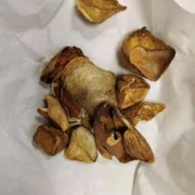 中药对怀孕有影响吗？一直在吃中药调理身体,穿山甲胎儿占母体大