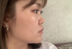 鼻子的拟人化30字,胎儿鼻梁偏短怎么办