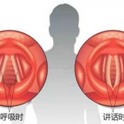 孕期喉咙沙哑（孕期喉咙沙哑疼痛怎么办）