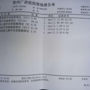 孕期甲亢检查（甲亢怎么检查）