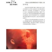 怀孕26周胎儿发育情况（怀孕26周胎儿发育情况如何）