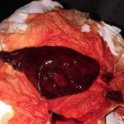 怀孕期间血块（怀孕期间血块像块肉一样是什么）