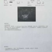 怀孕宫腔积液是是什么原因造成的怎么治,孕期宫腔积血怎么办能治好吗