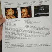 怎么知道宝宝面向你还是背对你,怎么看胎儿脸朝里脸朝外