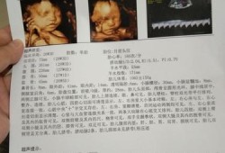 怎么知道宝宝面向你还是背对你,怎么看胎儿脸朝里脸朝外