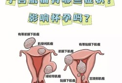 子宫肌瘤影响胎儿吗（孕妇子宫肌瘤影响胎儿吗）