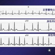 孕期心电图窦性心律（正常窦性心律什么意思）