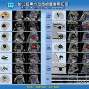 26周胎儿心脏发育标准（26周胎儿心脏发育标准是多少）
