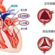 胎儿心脏返流（胎儿心脏返流是怎么回事）
