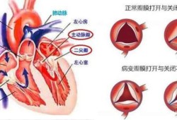 胎儿心脏返流（胎儿心脏返流是怎么回事）