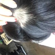 孕期掉头发吗（孕期掉头发吗）