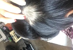 孕期掉头发吗（孕期掉头发吗）