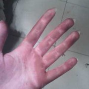 孕期染发剂（孕期染发剂沾到手上会怎么样）